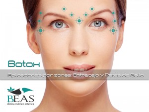 clínica beas en aguilas - botox