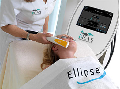 fotorejuvenecimiento-clinica-beas-ellipse